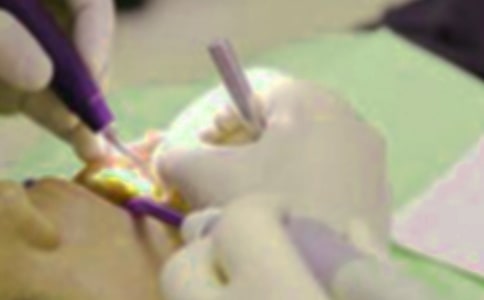 (实用)拔牙经历作文3篇